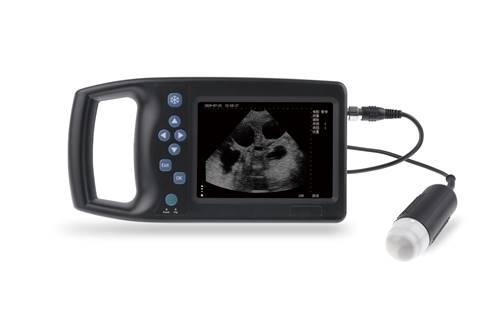 掌上B超M6